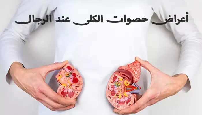 أعراض حصوات الكلى عند الرجال