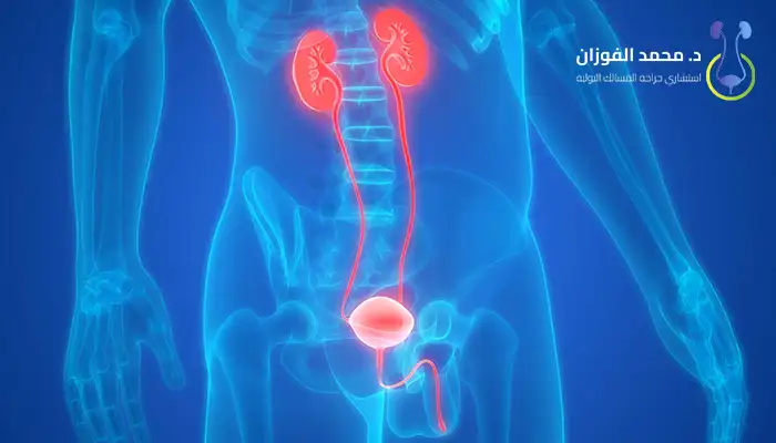 الكشف المبكر عن أورام الجهاز البولي