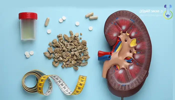 10 طرق فعّالة للوقاية من حصوات الكلى