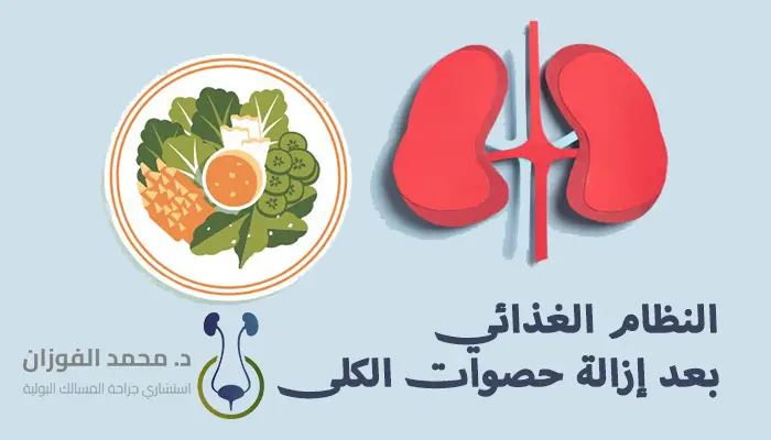 النظام الغذائي بعد إزالة حصوات الكلى