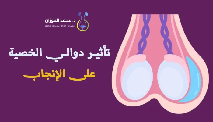 تأثير دوالي الخصية على الإنجاب