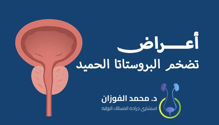 أعراض تضخم البروستاتا الحميد