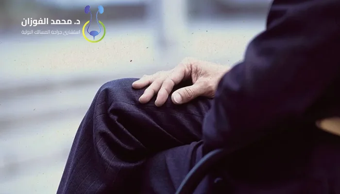 جراحة علاج الذكر المدفون