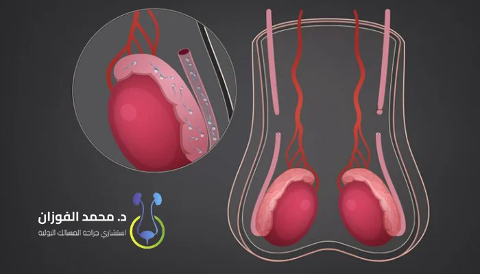 أفضل عيادة مسالك بولية بنتائج مضمونة