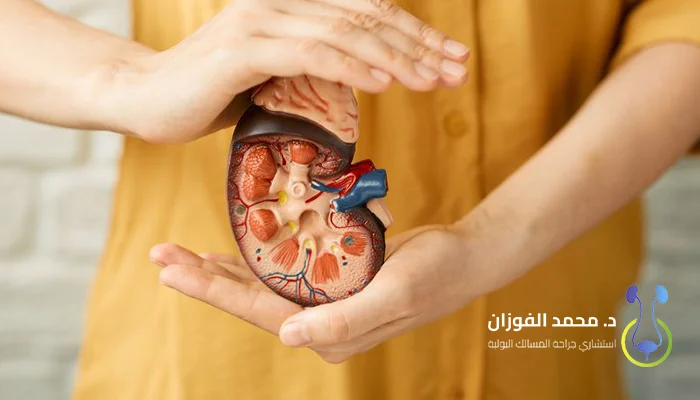 أفضل عيادة لرعاية ما بعد زراعة الكلى بالرياض