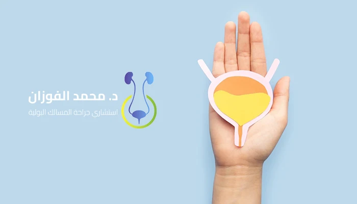 أفضل عيادة للكشف المبكر عن سرطان المثانة