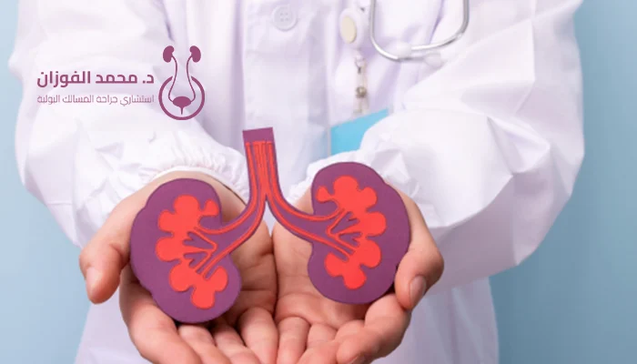 أفضل مركز للكلى في الرياض