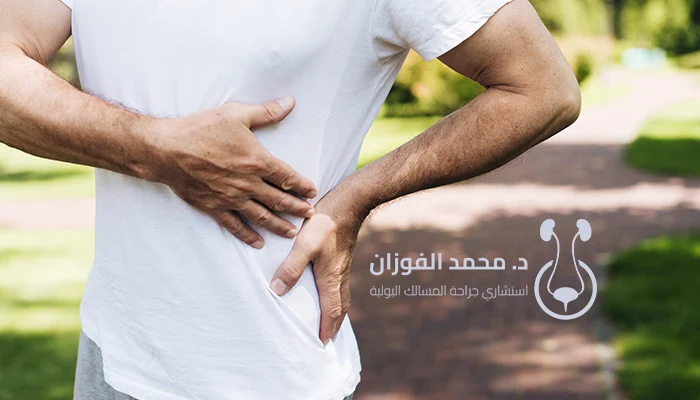 تفتيت حصوات الكلى بالليزر بالرياض