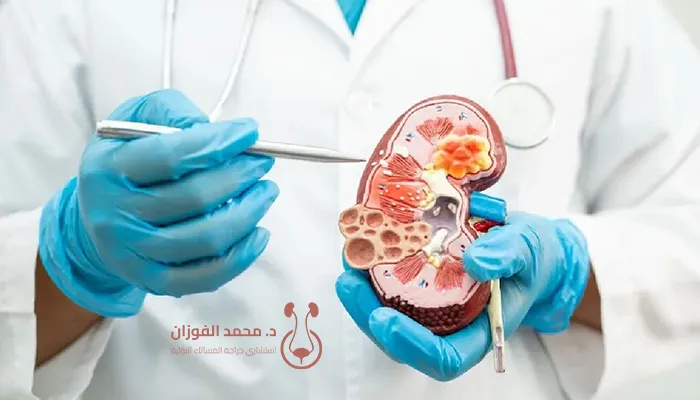 أفضل عيادة للكلى بالرياض