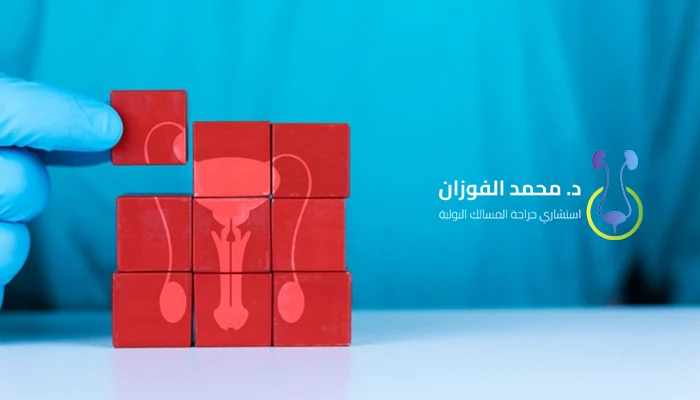 تأثير دوالي الخصية على الحيوانات المنوية