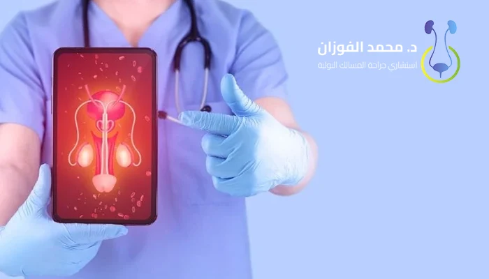 نسبة نجاح عملية دوالي الخصية