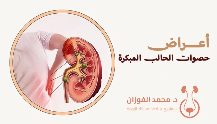 أعراض حصوات الحالب المبكرة