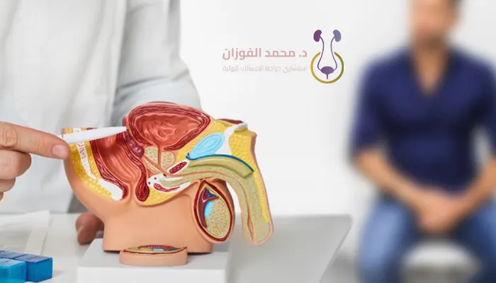 علاج تضخم البروستاتا بدون عملية