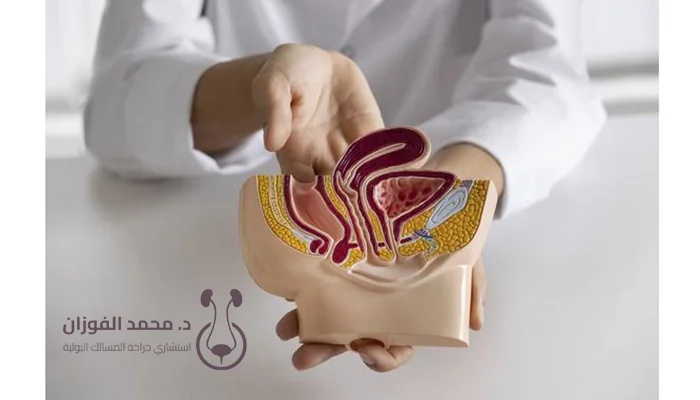 أسباب تضخم البروستاتا في سن مبكر