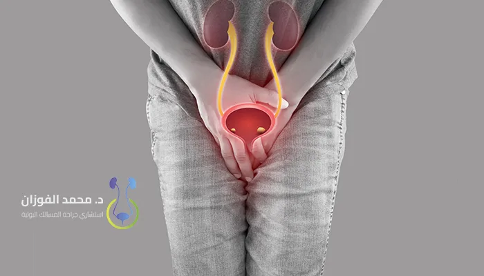 أعراض تضيق القناة البولية