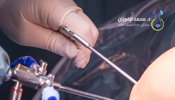 أفضل عيادة لعملية دوالي الخصية بالمنظار بالسعودية