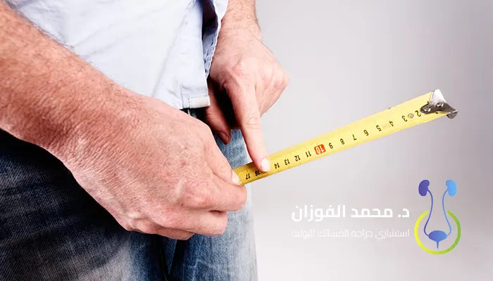 هل عملية تكبير العضو دائمة النتائج؟