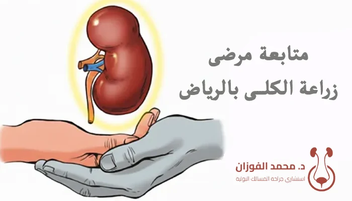أفضل عيادة لمتابعة مرضى زراعة الكلى بالرياض