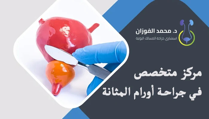 أفضل مركز متخصص في جراحة أورام المثانة