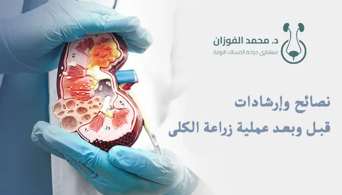 نصائح وإرشادات قبل وبعد عملية زراعة الكلى