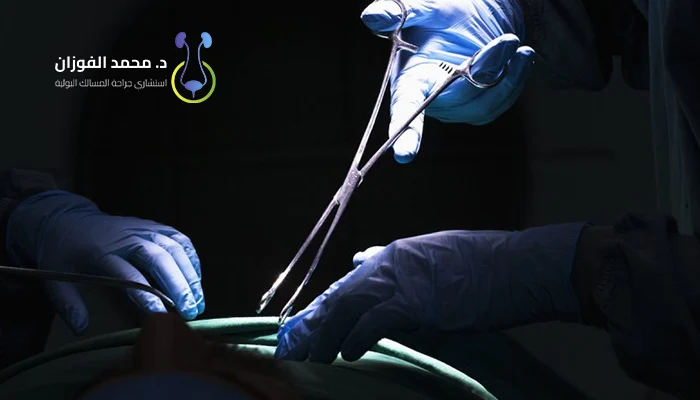 هل عملية العضو المدفون خطيرة؟