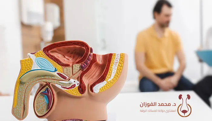 علاج تضيق القنوات البولية بالليزر